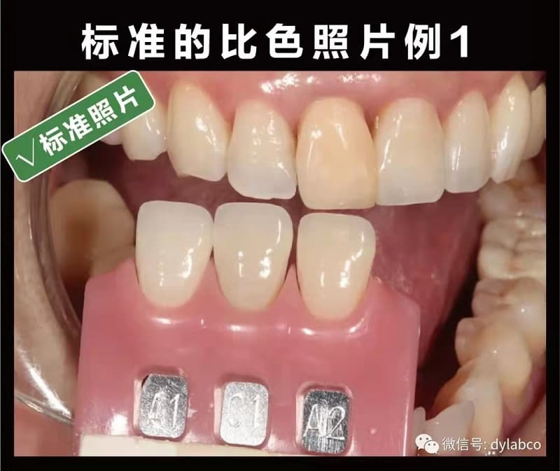 《醫技溝通篇》——技師需要什么樣的比色照片